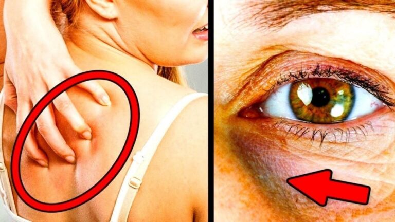 Difficile da credere, ma questi segnali rivelano il tuo consumo eccessivo di zucchero…