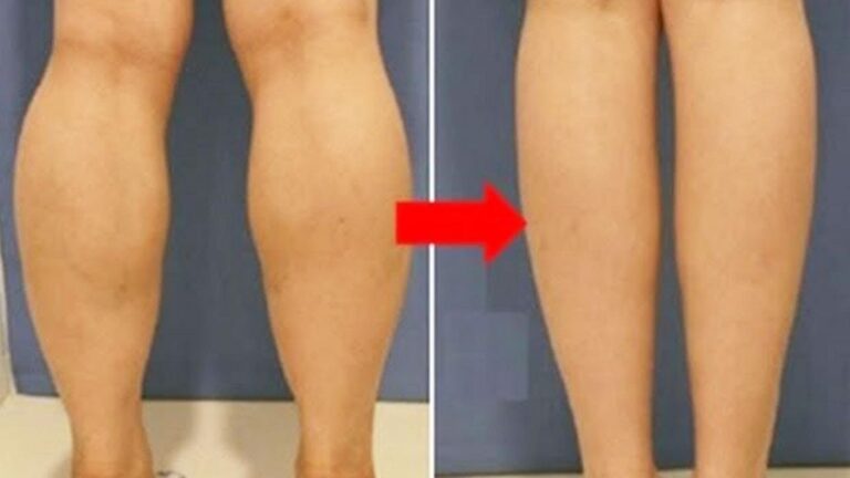 Questo semplice gesto trasforma le tue gambe in poche settimane… scopri come!