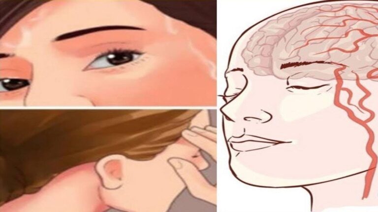 Un vecchio trucco per riconoscere i segnali premonitori di un ictus…