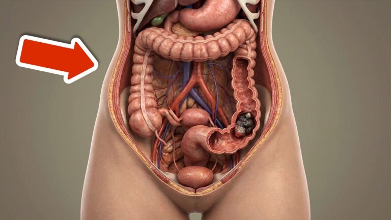 7 sintomi di cancro al colon che non puoi ignorare per salvarti la vita!