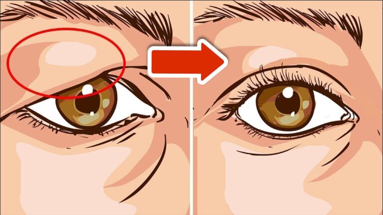 5 trucchi per eliminare subito le palpebre cadenti e sentirti al top!