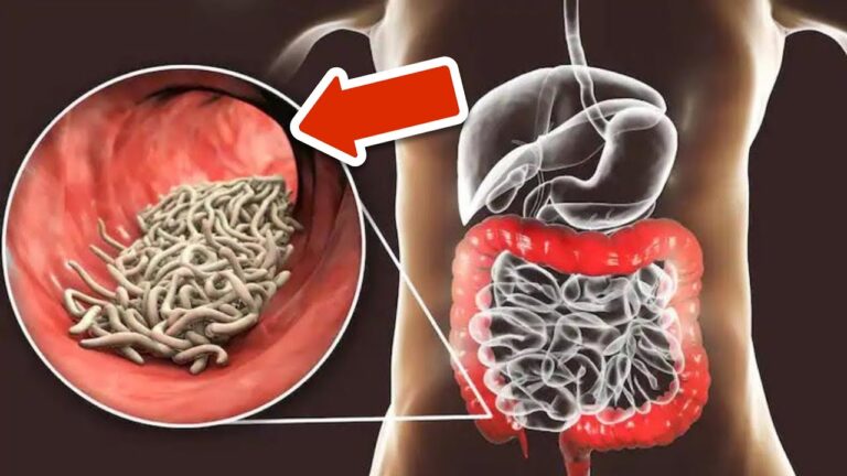 Scopri i 2 ingredienti per eliminare parassiti e vermi dal corpo!