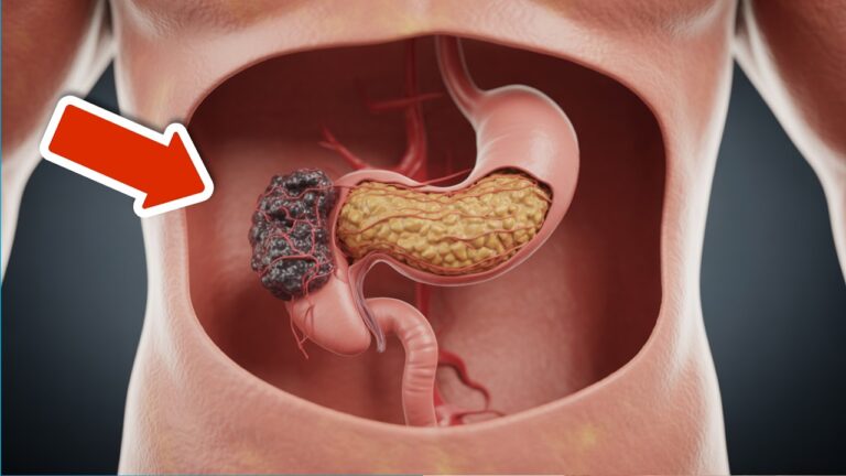 7 segnali di allerta che indicano il cancro e che non dovresti ignorare