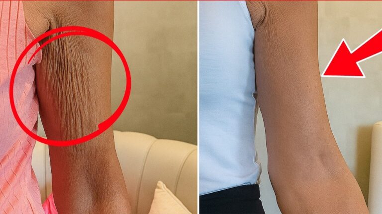 Scopri 5 rimedi segreti per eliminare la pelle rugosa in modo facile e veloce!