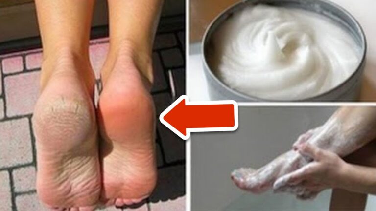 Elimina 5 problemi ai piedi con questo rimedio domestico segreto!