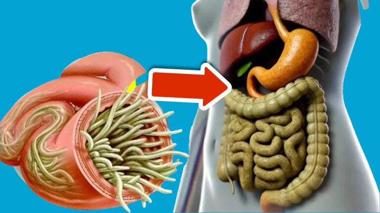 Scopri 5 cibi per eliminare i parassiti intestinali in pochi minuti!