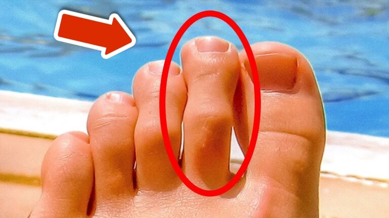8 segni che il tuo corpo ha bisogno di aiuto: scopri i segnali importanti!