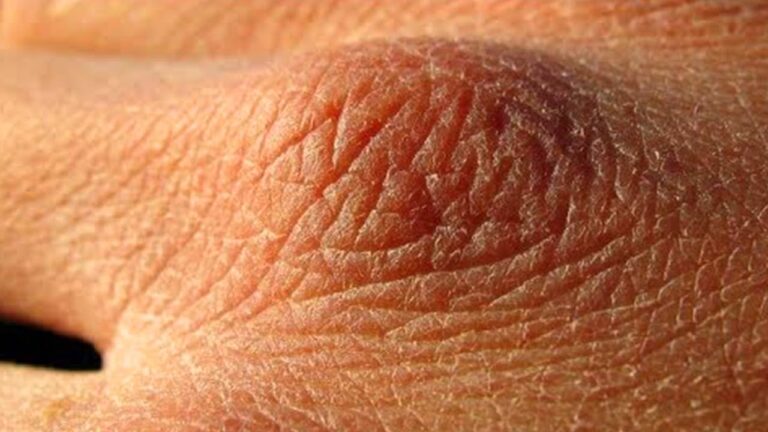 10 segni che bevi troppo poco acqua: scopri se sei a rischio!