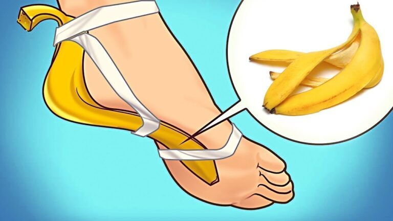 7 sorprendenti usi delle Bananenschalen che non conoscevi! Scopri di più!
