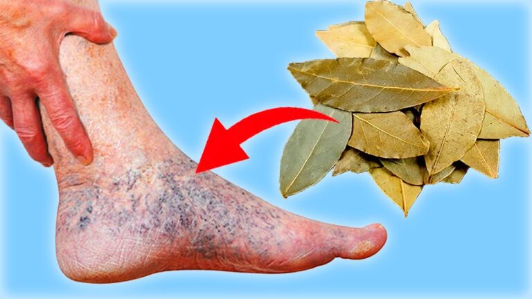 3 Alimenti per Dire Addio a Vene Varicose e Dolori! Scopri come cambiar vita!