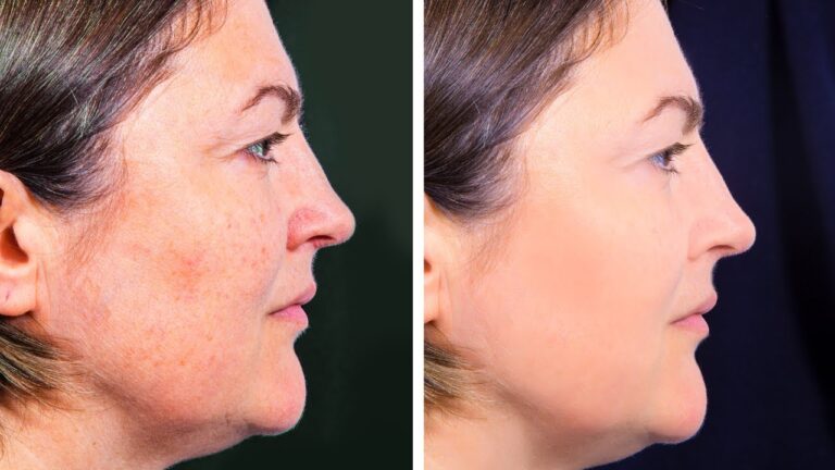 Elimina 5 macchie della pelle con rimedi naturali semplici e efficaci!