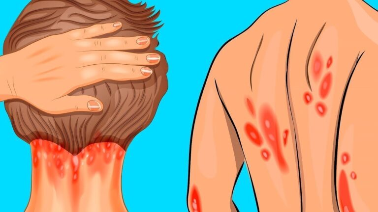 7 segni di carenza di vitamina D che non puoi ignorare
